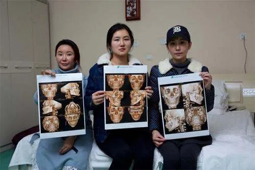 韩国整形业幽灵手术遭曝光是怎么回事？