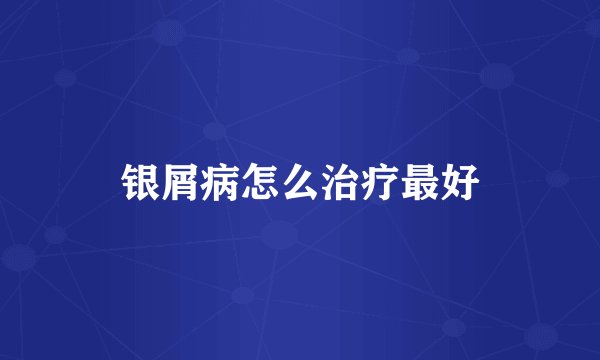 银屑病怎么治疗最好