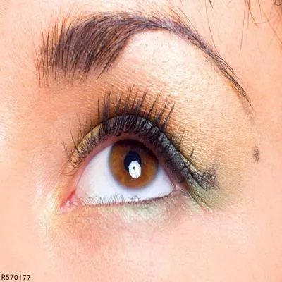 开眼角手术会有什么后遗症 开眼角手术易引发两个后遗症