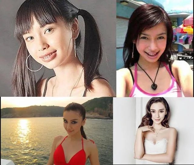 拔智齿真的可以瘦脸吗？有何依据？