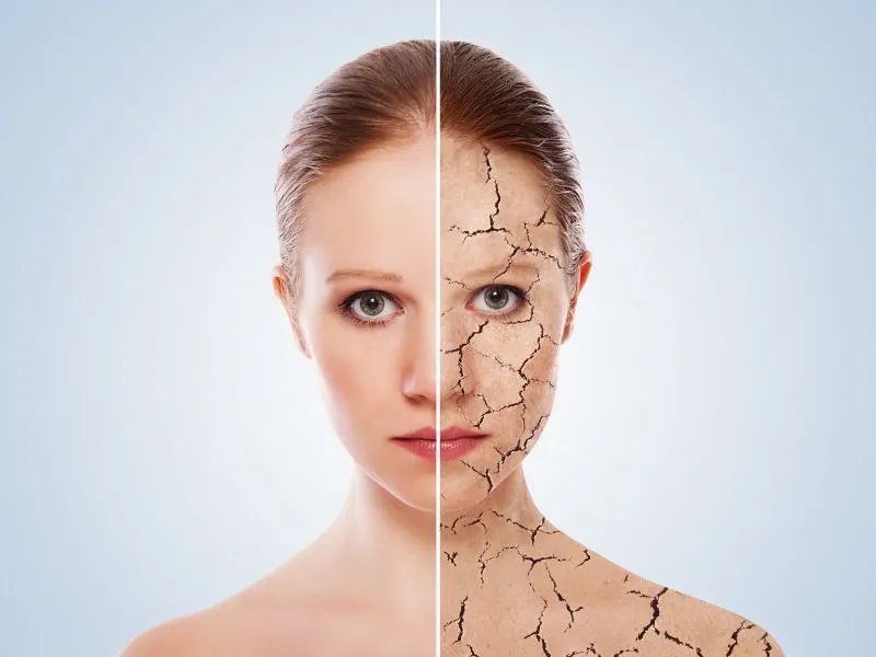 怎么收缩脸上的毛孔