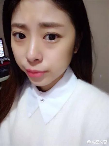 拔智齿真的可以瘦脸吗？有何依据？