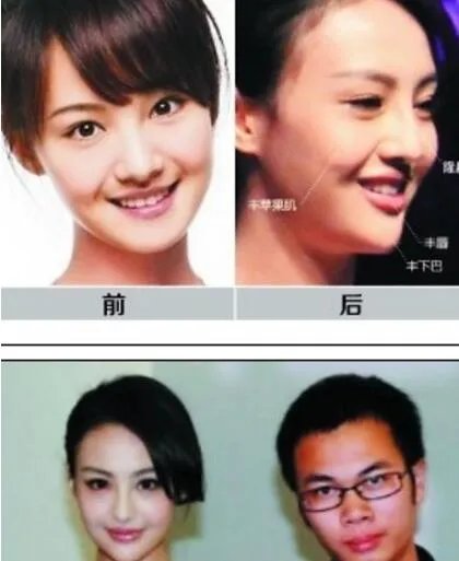 郑爽整容后照片大全绝密流出 前后对比判若两人