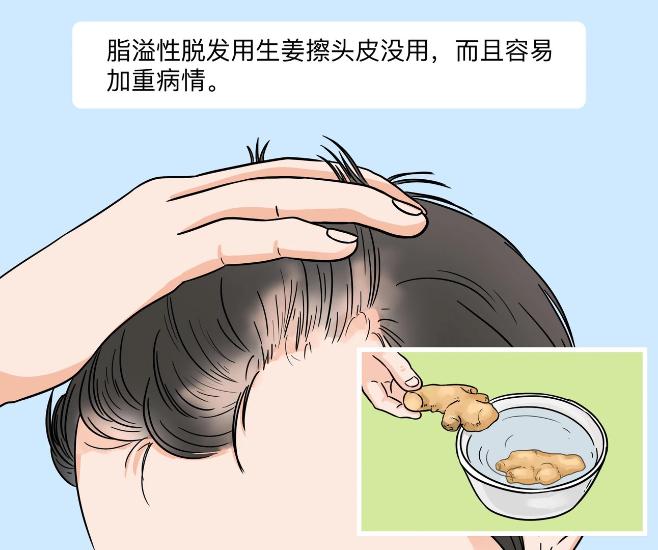 脂溢性脱发用生姜擦头皮有用吗