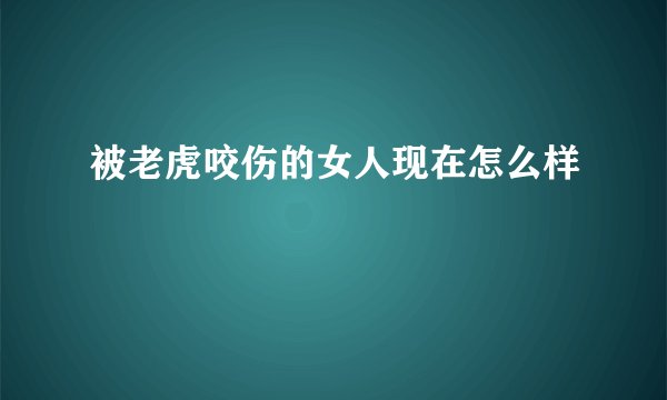 被老虎咬伤的女人现在怎么样