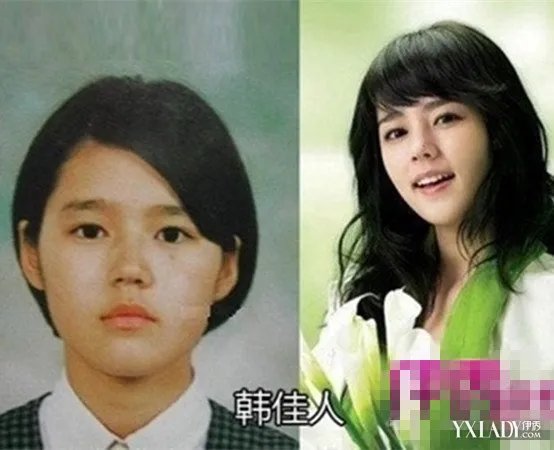 曝韩佳人整容前后对比其外貌竟是女生们模仿的模范