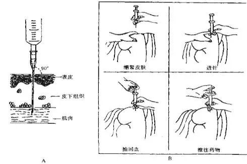 可善挺注射部位图