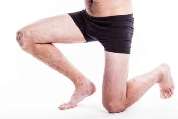 烫伤不抹药会留疤吗 如何避免留下烫伤疤