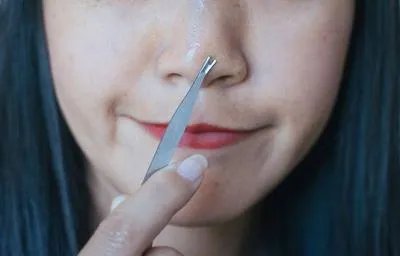 酒糟鼻用什么药能治好