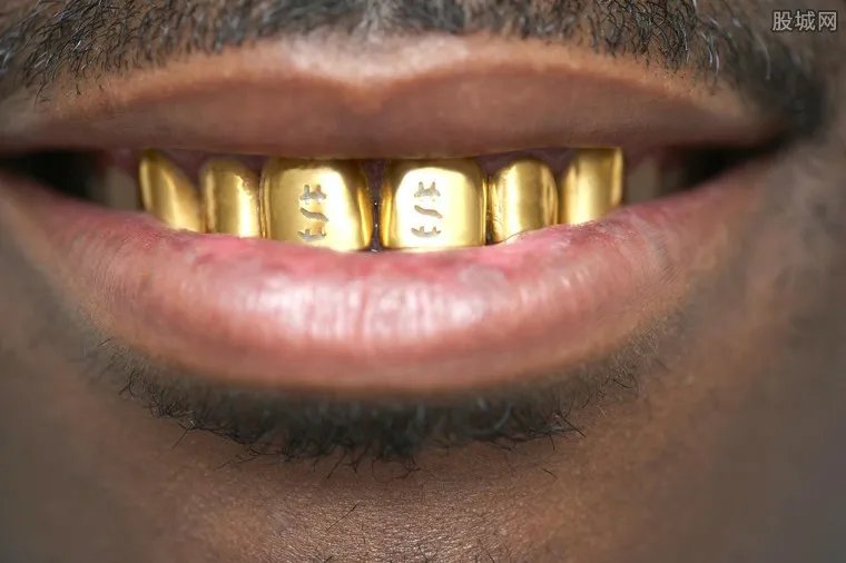 镶金牙检测不含金 在牙医诊所镶金牙多少钱？