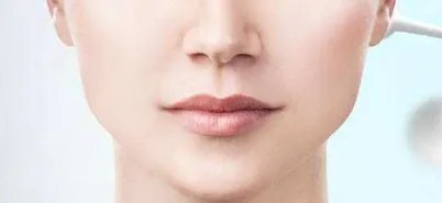 激光去斑价格多少