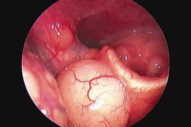 小孩过敏症状图片