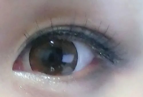 双眼皮贴哪种好