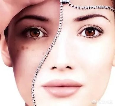 怎么去掉眼周色斑？