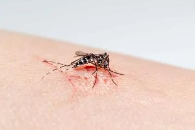 恙虫咬人应该怎么处理