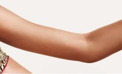 保定吸脂瘦手臂整形医院哪个效果靠谱 | 一般需要多少钱_手臂如何减肥啊，急急急