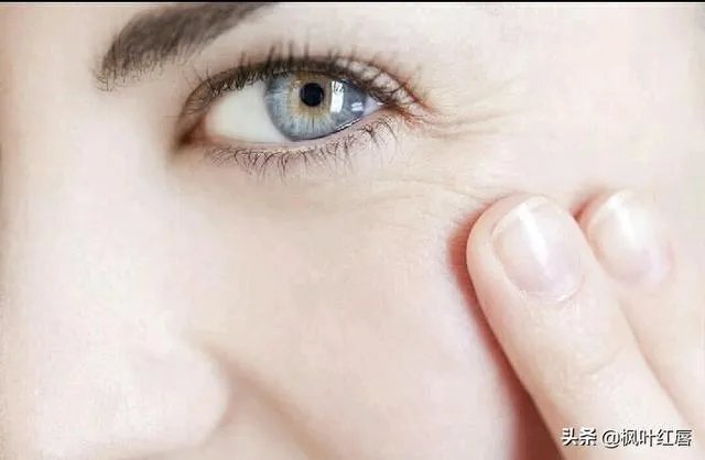 请问眼贴以及眼霜使用后细纹增多有可能是什么原因导致的？