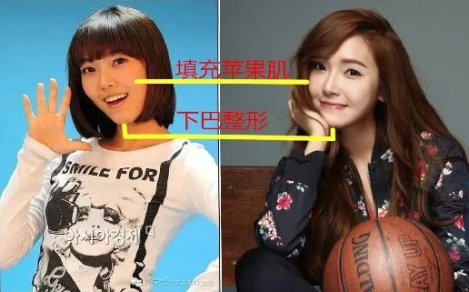 郑秀妍整容后更美了?郑秀妍整容前后照对比（图）