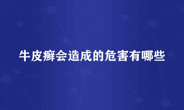 牛皮癣会造成的危害有哪些
