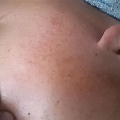 怎么样能不长老年斑?