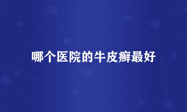 哪个医院的牛皮癣最好