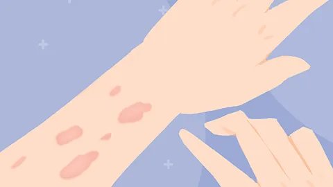 皮肤为什么越抓越痒