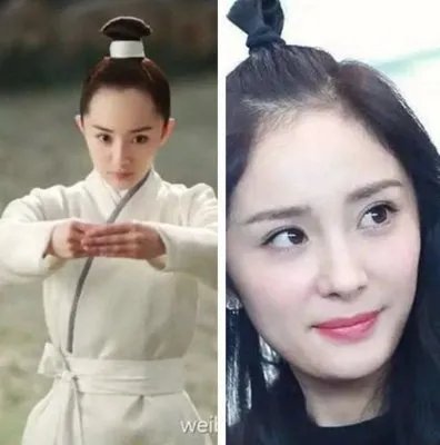 杨幂发际线为什么这么高？