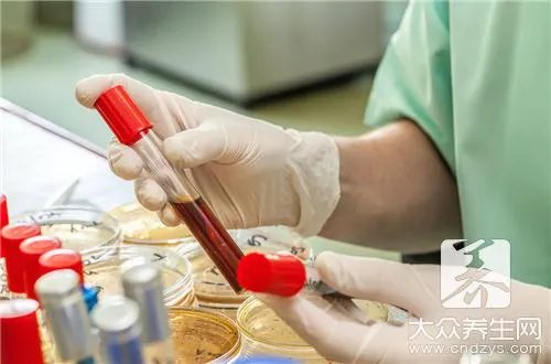 学会利用膳食美容赶走蜡黄脸！