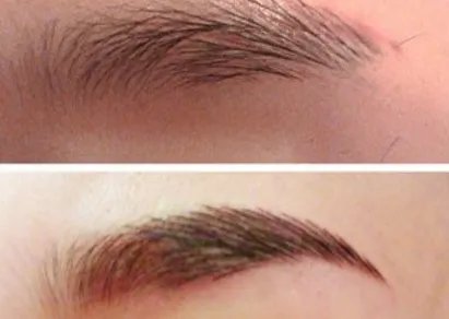 纹眉价格是多少