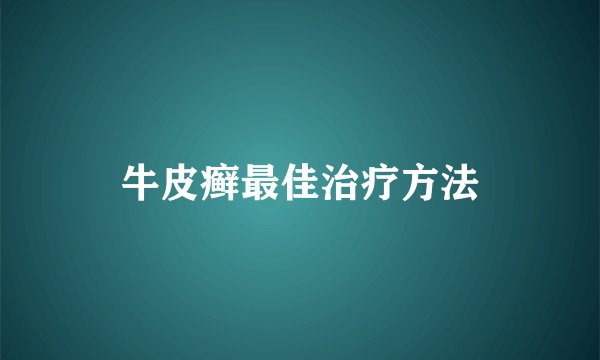 牛皮癣最佳治疗方法