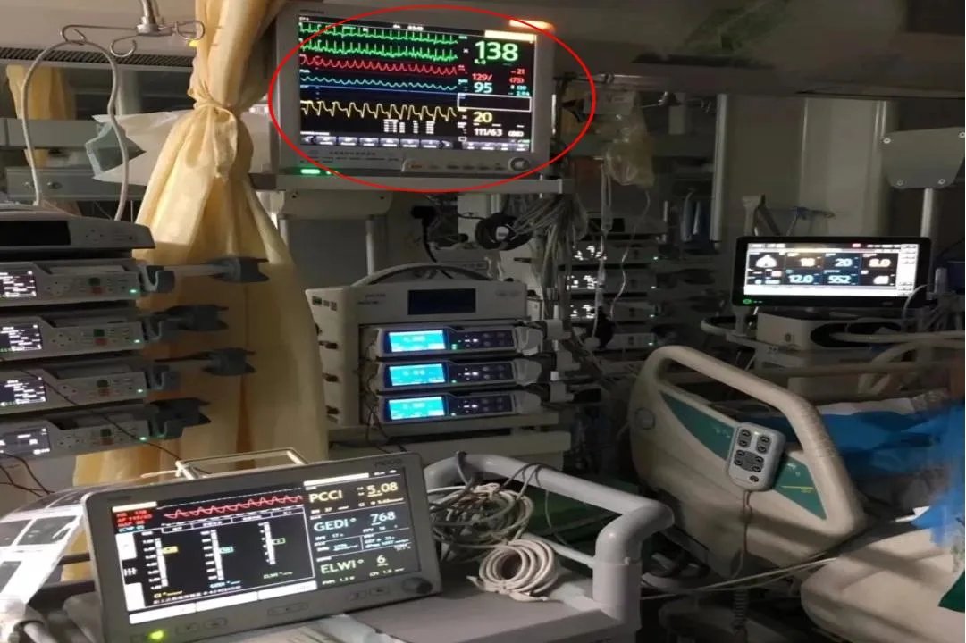 床旁心电图位置图片