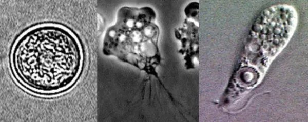 美国现可怕的“食脑虫”，如何才能避免被感染？