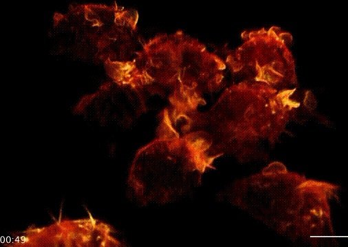 猜测下，一周后美国新冠肺炎累计确诊病例会有多少呢？30万、40万？