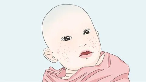 婴儿干咳是什么原因