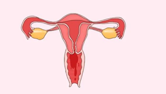 白色念珠菌病有什么症状