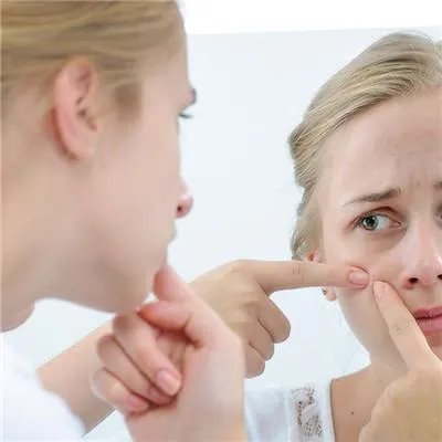 去痘印的好方法