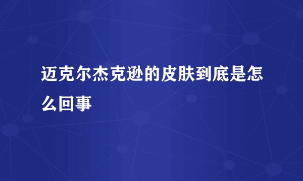 迈克尔杰克逊的皮肤到底是怎么回事