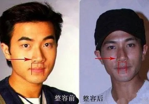 刘恺威整容前后照片  变化巨大获称假面小生！