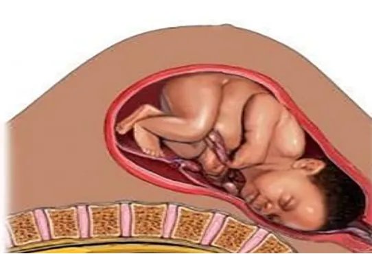 枕左前位置示意图