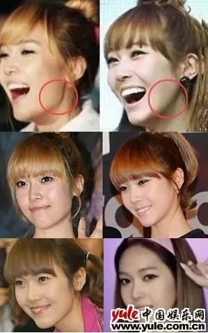话说现在网上对于少女时代整容前的照片是真的吗？尤其是jessica和yuri的，以前的很吓人，但是真的吗？