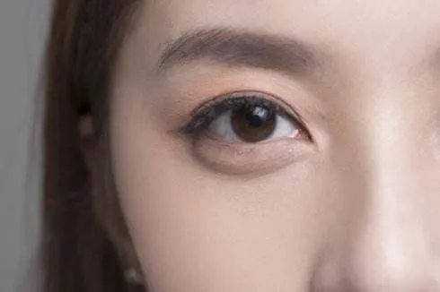 做双眼皮手术大概多少钱