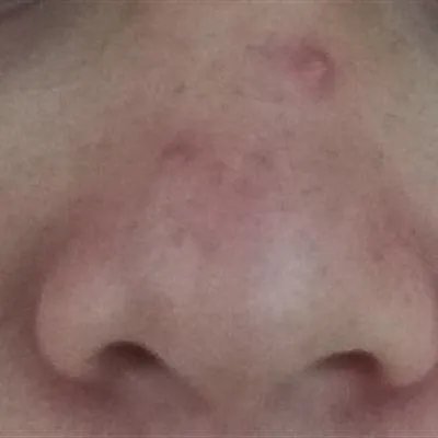 怎么样能不长老年斑?