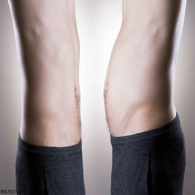 男人将军肚的减肥方法