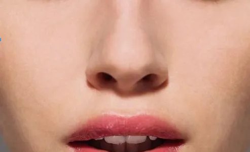 激光祛斑大约要多少钱