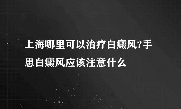 上海哪里可以治疗白癜风?手患白癜风应该注意什么