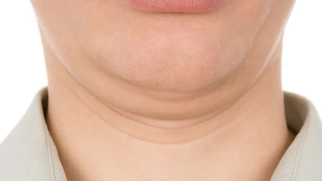 削骨手术怎么做